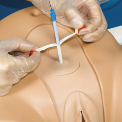 Suprapubic catheterisation